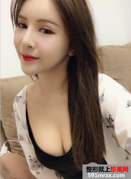 自体脂肪丰胸价格|真人案例效果对比照片分享
