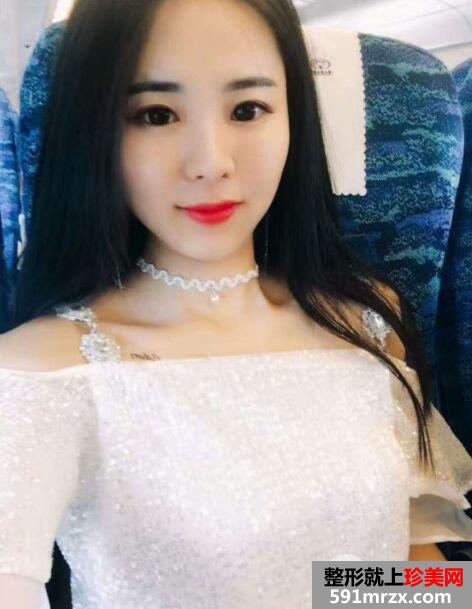 埋线面部提升真人效果对比图，立现鹅蛋脸