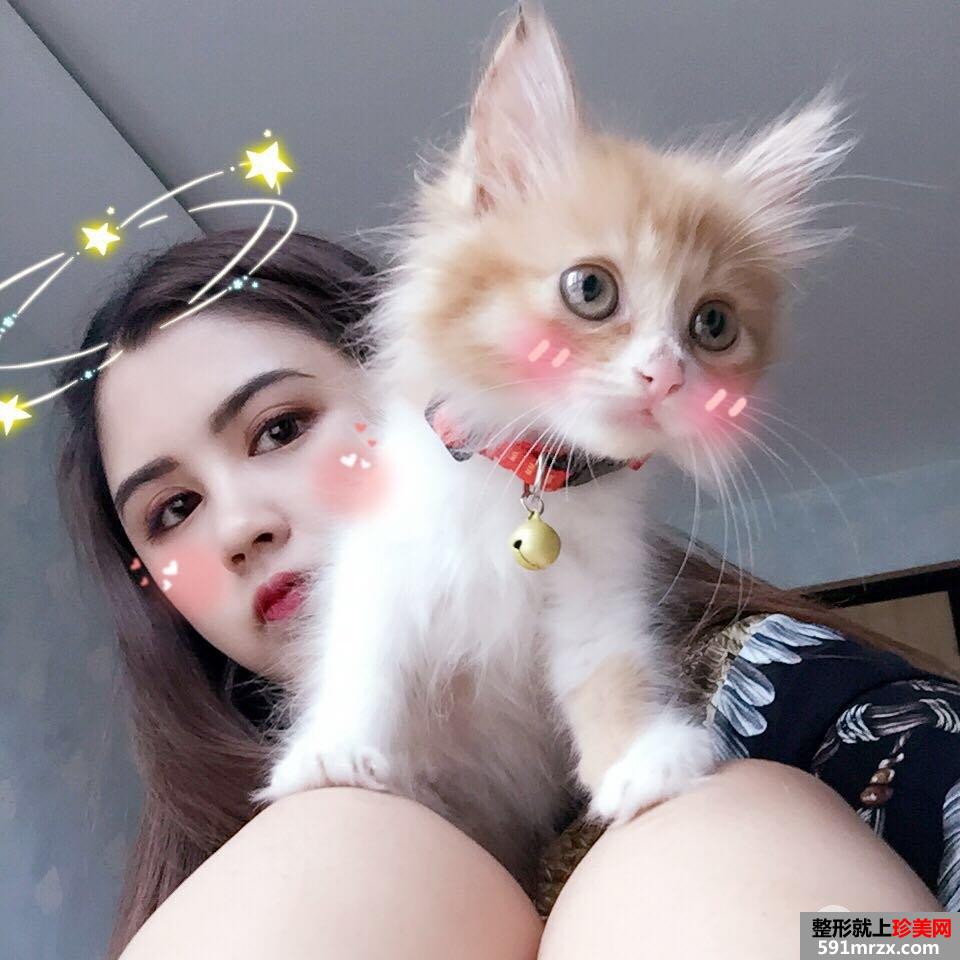 双眼皮修复+开眼角案例图片对比，欧式双眼皮get！