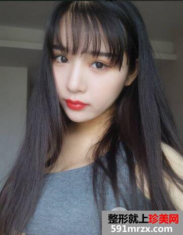面部吸脂瘦脸效果案例对比图，立现精致小脸
