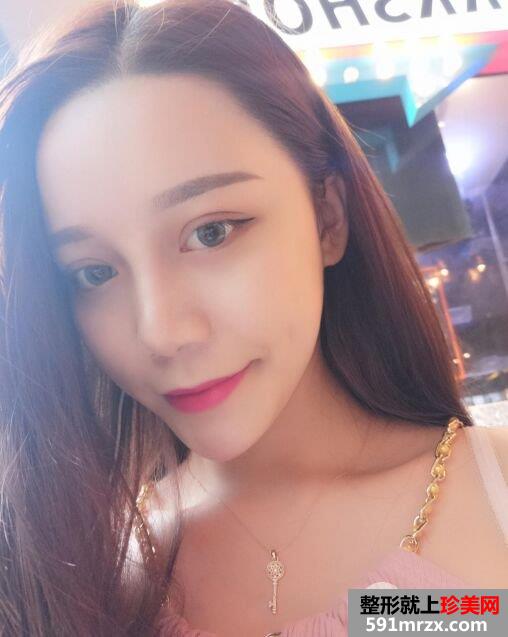 做双眼皮手术过程图详细介绍 血腥胆小勿入！