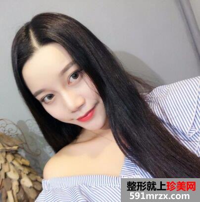 做双眼皮手术过程图详细介绍 血腥胆小勿入！