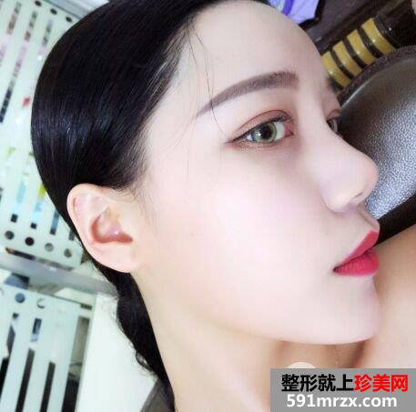 做双眼皮手术过程图详细介绍 血腥胆小勿入！