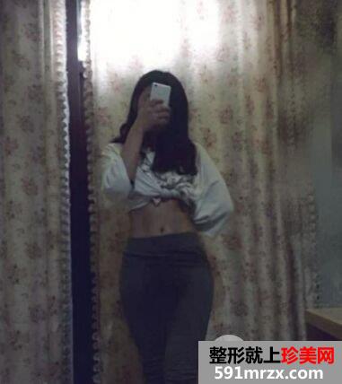 环形吸脂减肥瘦腰腹真实案例对比图，拥有小蛮腰