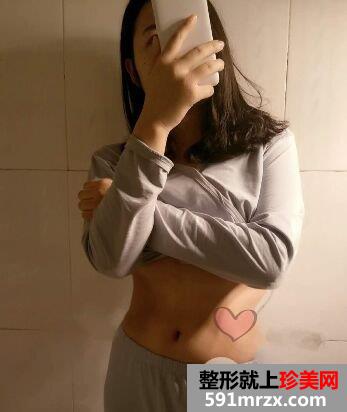 环形吸脂减肥瘦腰腹真实案例对比图，拥有小蛮腰