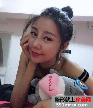 鼻综合整形|整鼻手术真人案例照片对比，轻松get小翘鼻