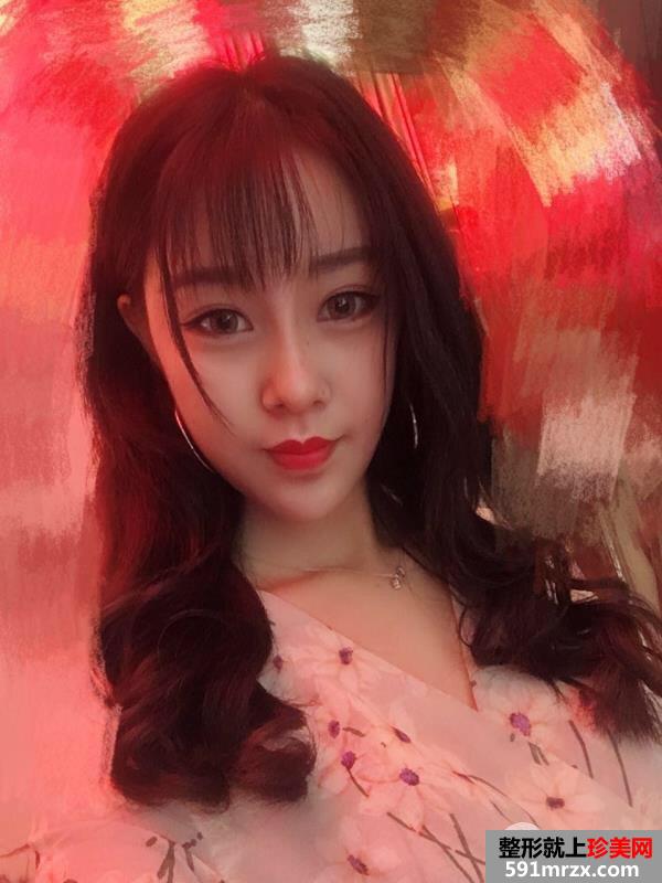 鼻综合整形|整鼻手术真人案例照片对比，轻松get小翘鼻