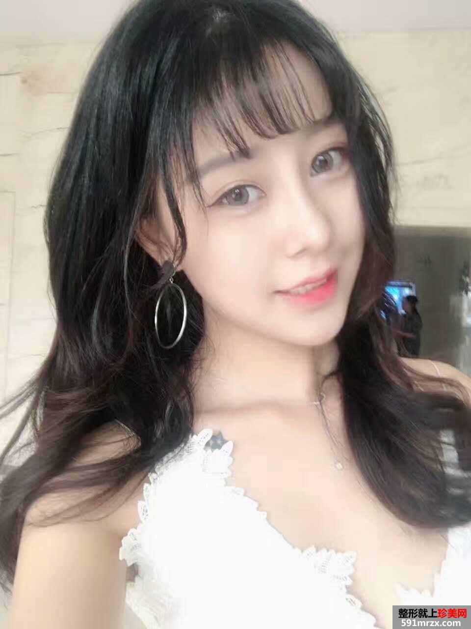 鼻综合整形|整鼻手术真人案例照片对比，轻松get小翘鼻