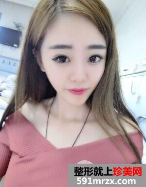 自体脂肪面部填充恢复全过程前后对比照片真人案例