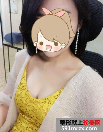 自体脂肪丰胸真实案例前后对比图，摇身一变性感美女