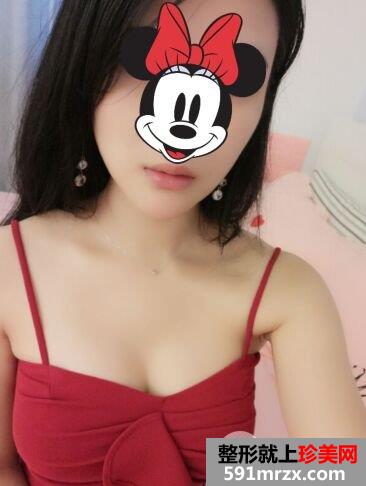 自体脂肪丰胸真实案例前后对比图，摇身一变性感美女