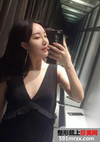 鼻综合整形+假体垫下巴真人日记完美蜕变对比照