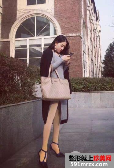 腰腹吸脂手术恢复效果对比照片摆脱“游泳圈”