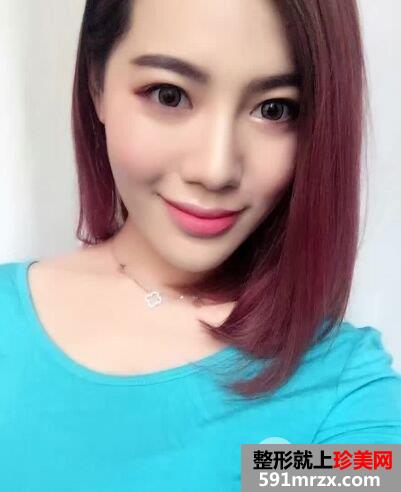 石家庄蓝山整形价格表自体脂肪面部填充价格案例照片分享