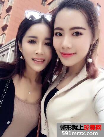 石家庄蓝山整形价格表自体脂肪面部填充价格案例照片分享