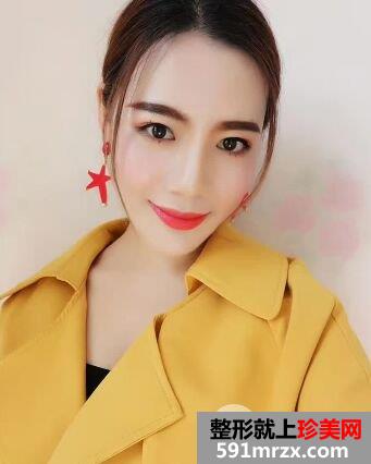 石家庄蓝山整形价格表自体脂肪面部填充价格案例照片分享