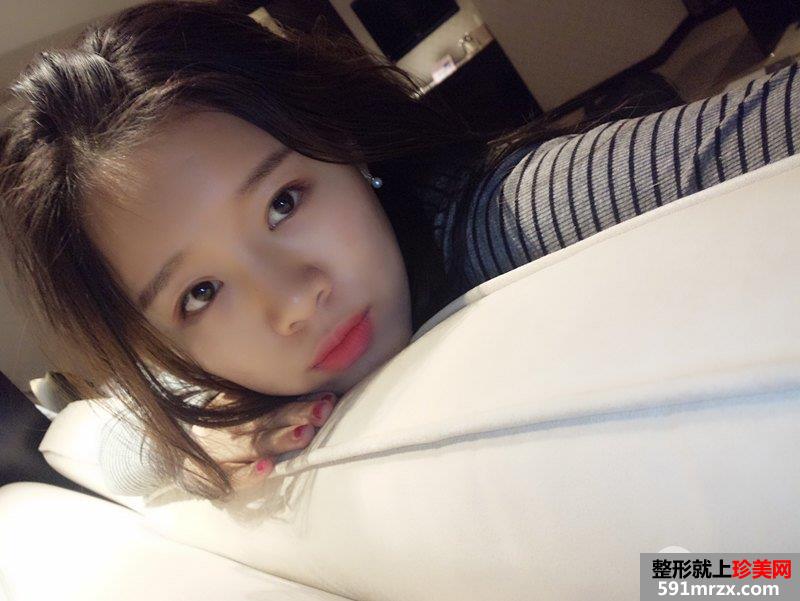 北京东方和谐整形价格表|自体脂肪面部填充价格真实案例照片分享