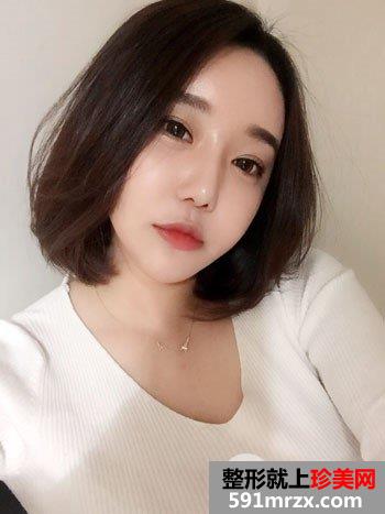 光子嫩肤做几次|光子嫩肤真实案例效果对比照片