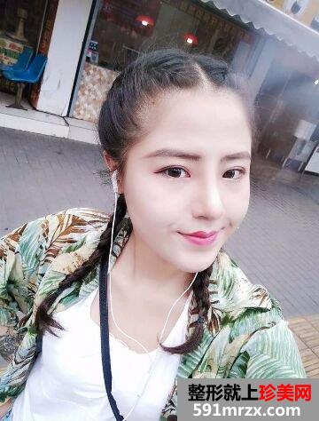 成都军大整形价格表|鼻头缩小术要多少钱及手术案例分享