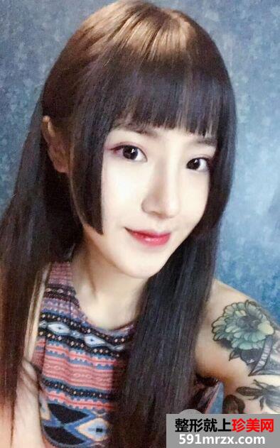 成都军大整形价格表|鼻头缩小术要多少钱及手术案例分享