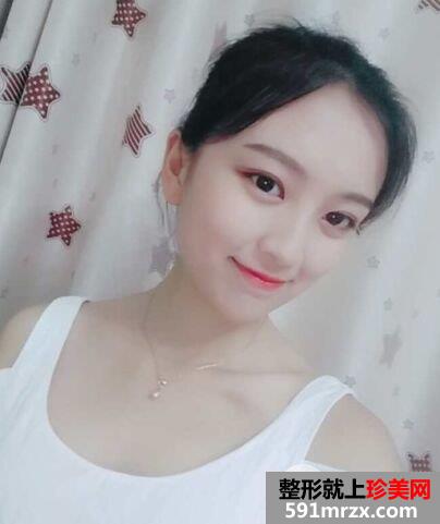 武汉新至美整形价格表|隆下颌真实案例立现鹅蛋脸
