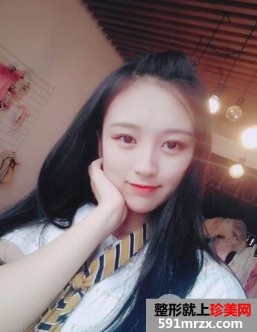 武汉新至美整形价格表|隆下颌真实案例立现鹅蛋脸