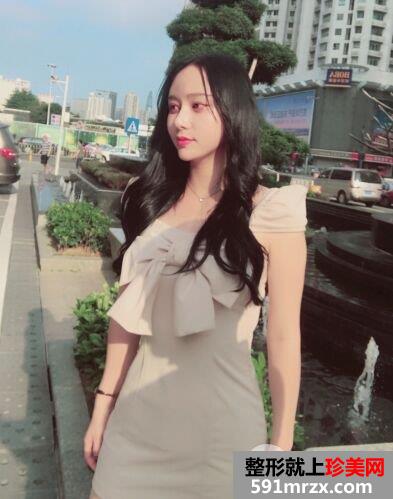 深圳臻瑞芝美整形价格表|腰腹吸脂真实案例小蛮腰立现