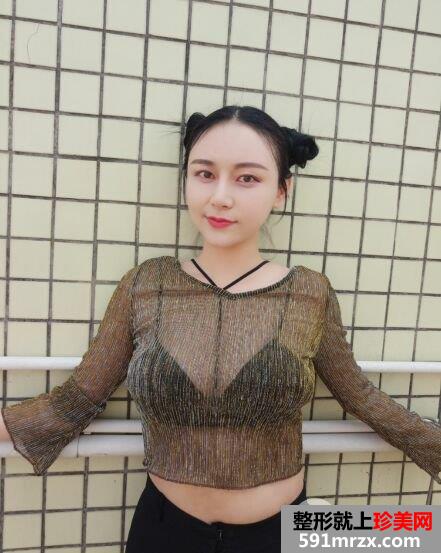 深圳臻瑞芝美整形价格表|腰腹吸脂真实案例小蛮腰立现