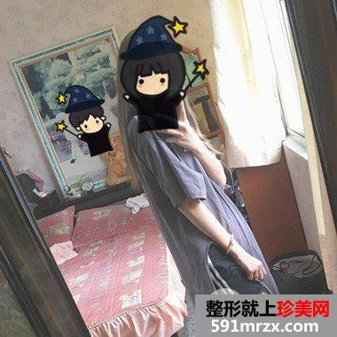 长沙素妍整形价格表|吸脂瘦腿案例分享立现筷子腿