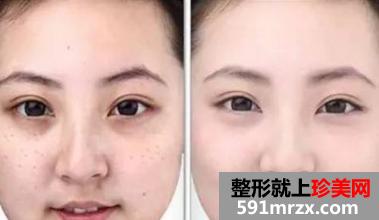烟台华美整形医院价格表新出炉