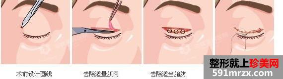 呼和浩特大韩整形医院价格表新新曝光
