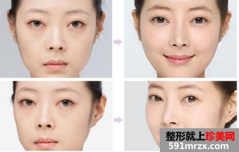 兰州时光激光整形美容医院价格表新曝光