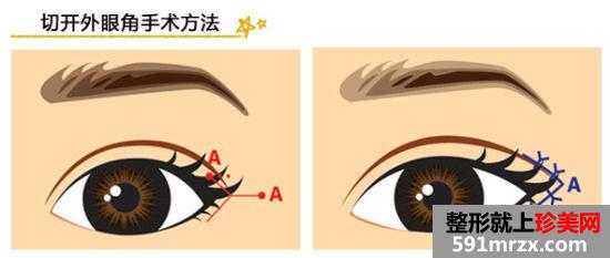 西安西京整形外科价格表一览