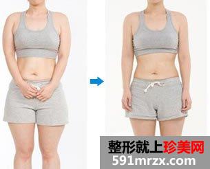 哈尔滨211医院整形美容科价格表价目一览