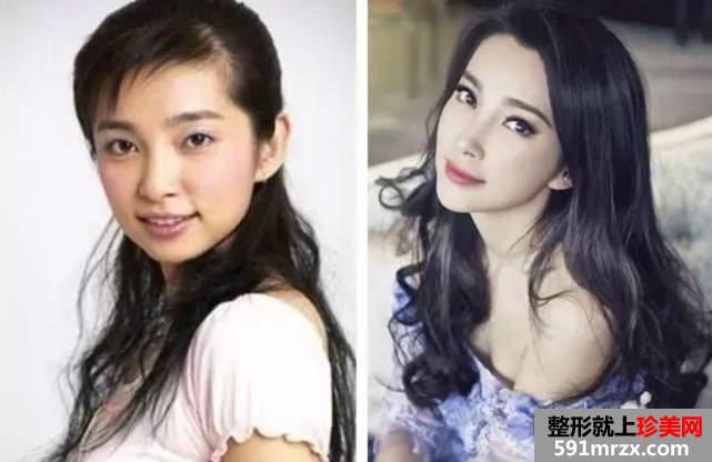 北京克莱美舍张冰杰医疗美容诊所整形价格表