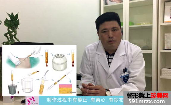 顾建成医生揭秘自体脂肪减龄的秘密
