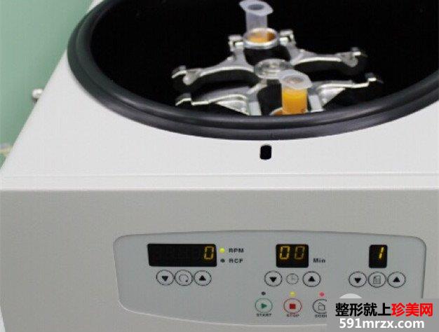 自体脂肪填充全面部前后对比效果照片和恢复过程分享给大家