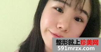 在美莱医院做了鼻综合整形手术价格虽贵但效果好