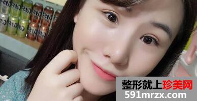 在美莱医院做了鼻综合整形手术价格虽贵但效果好