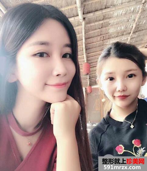 北京禾美嘉自体脂肪面部填充案例