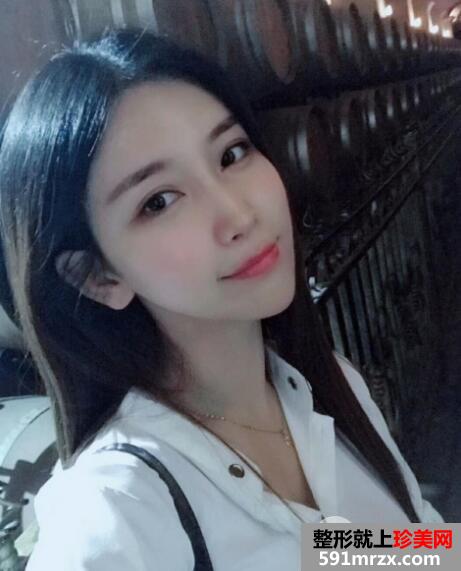 北京禾美嘉自体脂肪面部填充案例