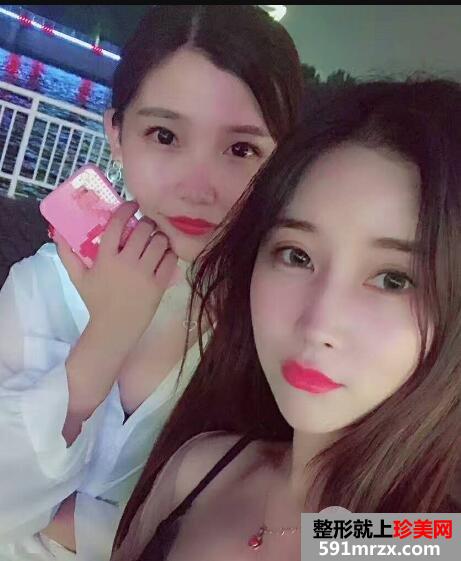 北京禾美嘉自体脂肪面部填充案例