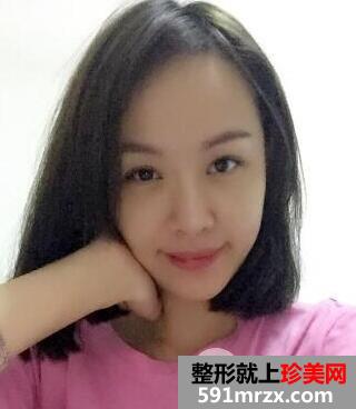成都恒博医院植发价格和案例