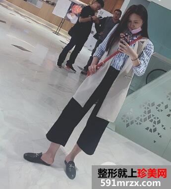 北京东方和谐自体脂肪面部填充价格适宜效果好案例