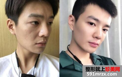 上海长征医院整形外科价格表