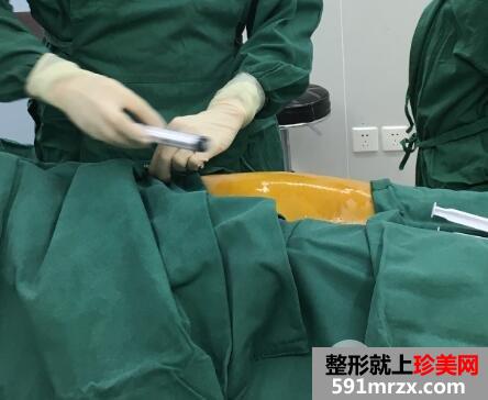 在北京禾美嘉整形脸部脂肪填充价格和4天图片案例