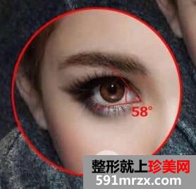 开眼角手术的安全性如何？