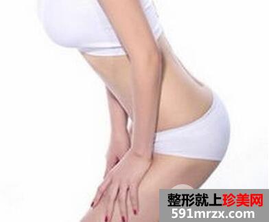 腰腹部抽脂贵吗？价格和什么因素有关?