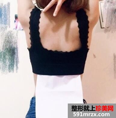 腹部吸脂后出现凹陷怎么办？腹部吸脂影响怀孕生孩子吗？