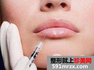 注射丰唇针靠谱吗？